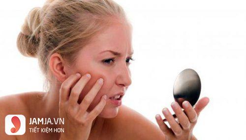 cách chữa da mặt bị dị ứng mỹ phẩm 5