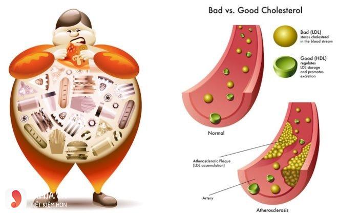 Sữa chua không đường giảm cholesterol trong máu