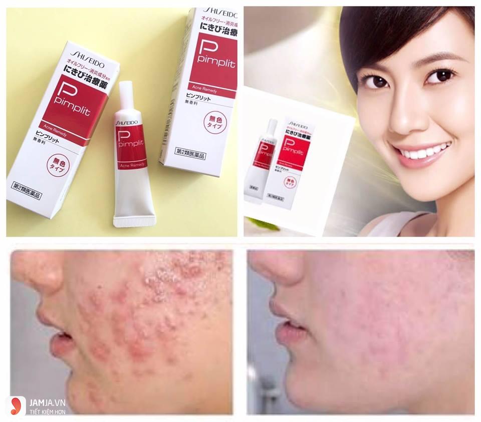 Kem trị mụn Shiseido Pimplit 3