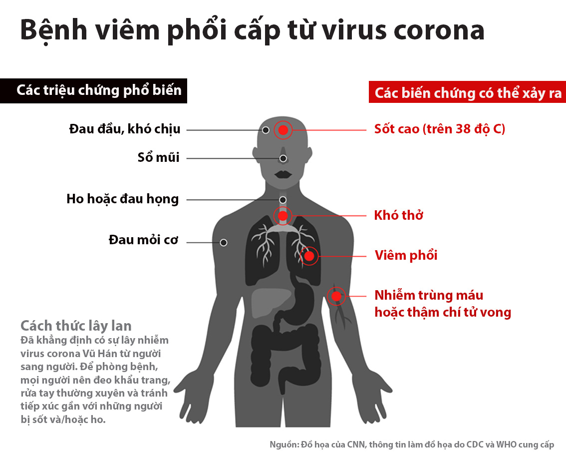 Triệu chứng nhiễm virut Corona